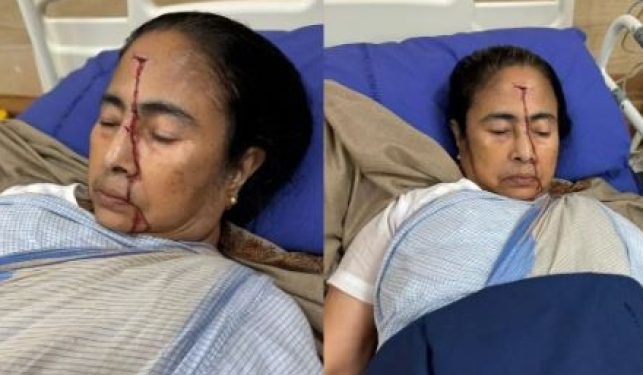 मुख्यमंत्री ममता बनर्जी की गाड़ी हुई हादसे का शिकार, सिर पर लगी चोट