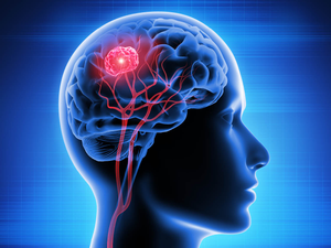 Health & Medicine : ਘਾਤਕ ਦਿਮਾਗ ਦੇ ਕੈਂਸਰ ਨਾਲ ਲੜਨ ਲਈ ਮੁੱਖ ਐਨਜ਼ਾਈਮ ਦੀ ਪਛਾਣ