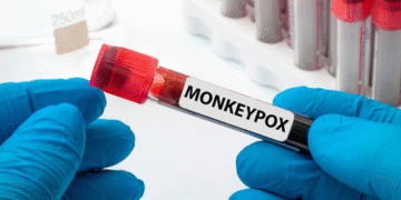 HEALTH & MEDICINE : ਨੀਦਰਲੈਂਡਜ਼ ਵਿੱਚ ਨਵੇਂ mpox ਵੇਰੀਐਂਟ ਦਾ ਪਹਿਲਾ ਮਾਮਲਾ ਆਇਆ ਸਾਹਮਣੇ