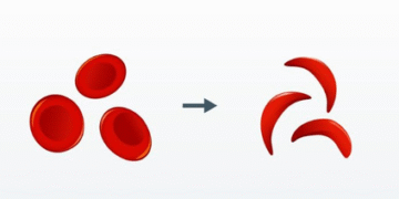  HEALTH & MEDICINE :  ਭਾਰਤ ਨੇ ਸਿਕਲ ਸੈੱਲ ਬਿਮਾਰੀ ਲਈ ਪਹਿਲੀ ਸਵਦੇਸ਼ੀ CRISPR-ਅਧਾਰਤ ਜੀਨ ਥੈਰੇਪੀ ਦੀ ਕੀਤੀ ਸ਼ੁਰੂਆਤ