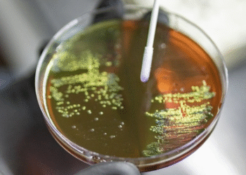 HEALTH & MEDICINE : ਗਰਭ ਅਵਸਥਾ ਦੌਰਾਨ ਐਂਟੀਬਾਇਓਟਿਕ ਦੀ ਵਰਤੋਂ ਬੱਚਿਆਂ ਵਿੱਚ ਵਧਾ ਸਕਦੀ ਹੈ ਬੈਕਟੀਰੀਆ ਸੰਬੰਧੀ ਬਿਮਾਰੀ ਦਾ ਖਤਰਾ