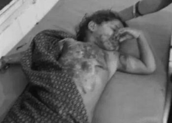 Punjab: 3 ਸਾਲ ਦੀ ਬੱਚੀ ਅੱਗ ਲੱਗਣ ਕਾਰਨ ਝੁਲਸੀ