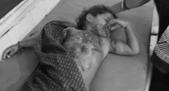 Punjab: 3 ਸਾਲ ਦੀ ਬੱਚੀ ਅੱਗ ਲੱਗਣ ਕਾਰਨ ਝੁਲਸੀ