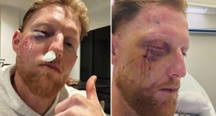 Cricket: ਇੰਗਲੈਂਡ ਟੈਸਟ ਟੀਮ ਕਪਤਾਨ ਨੇ ਆਪਣੇ ਸਭ ਤੋਂ ਵੱਡੇ ਡਰ ਦਾ ਕੀਤਾ ਖੁਲਾਸਾ: ਕਿਹਾ ”ਸ਼ਾਇਦ ਮੈਂ ਅੱਜ ਇੱਥੇ ਨਾ ਹੁੰਦਾ”