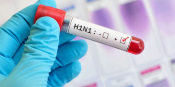 Punjab: H1N1 ਨੂੰ ਲੈ ਕੇ ਪੰਜਾਬੀਆਂ ਲਈ ਨਵੀਂ Update!