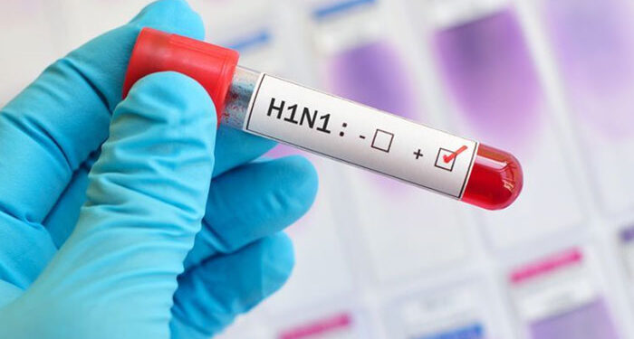 Punjab: H1N1 ਨੂੰ ਲੈ ਕੇ ਪੰਜਾਬੀਆਂ ਲਈ ਨਵੀਂ Update!