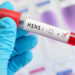 Punjab: H1N1 ਨੂੰ ਲੈ ਕੇ ਪੰਜਾਬੀਆਂ ਲਈ ਨਵੀਂ Update!